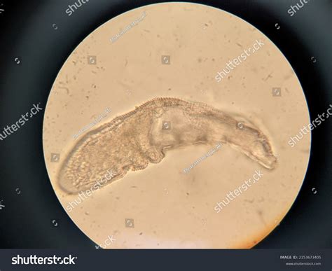 Photo Demodex Face Mites Under Microscope Stock Photo 2153673405 | Shutterstock