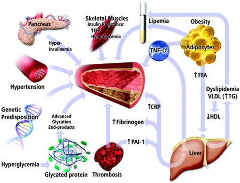 Diabetic Macrovascular Disease | Circulation | Marea Brava