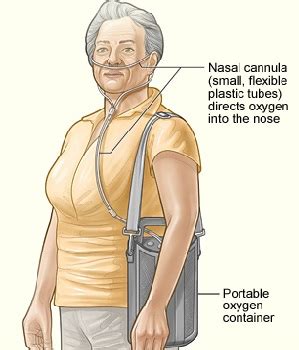 Chronic Respiratory Failure: Symptoms, Causes & Treatment | Study.com