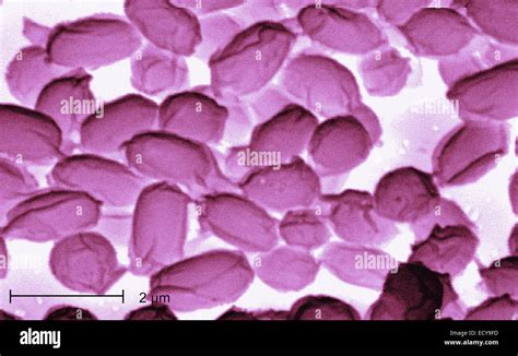 Photomicrograph of Bacillus anthracis (anthrax) spores Stock Photo - Alamy