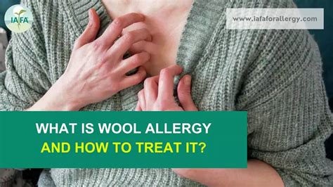 What is Wool Allergy and How to Treat It?