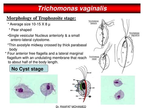 What Is The Morphology Of T Vaginalis | SexiezPicz Web Porn