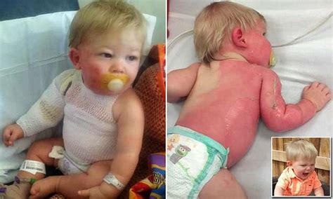 Arizona boy suffers second-degree burns after being hit by scalding hot water | Daily Mail Online