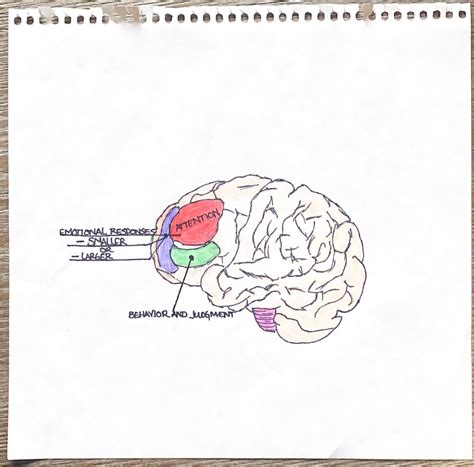 BIPOLAR DISORDER AND THE BRAIN. – Human STEAM