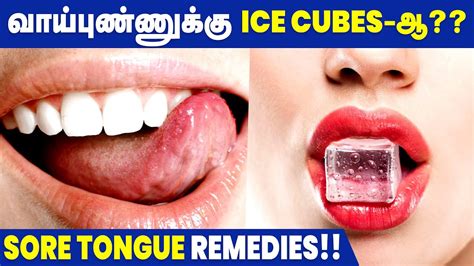 Sore Tongue Causes, Treatments & Home Remedies | Health Tips - YouTube