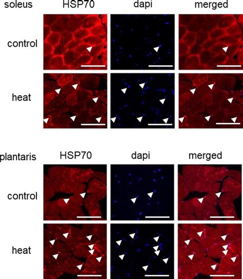 Frontiers | Nuclear Accumulation of HSP70 in Mouse Skeletal Muscles in Response to Heat Stress ...