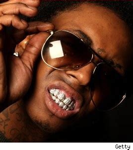 Lil Wayne Diamond Teeth Removed