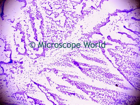 Microscope World Blog: Staphylococcus Under the Microscope