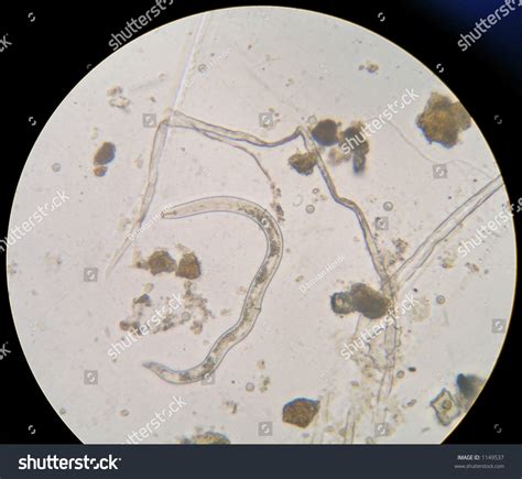 Nematode (Tiny Parasitic Worm) Under Microscope Stock Photo 1149537 : Shutterstock