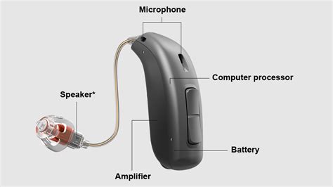 A guide to hearing aids: What kind is best for you? - SoundGuys