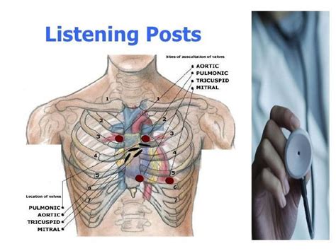 Pin by Andres Sanchez on Physical Exam | Heart sounds, Sound, Heart