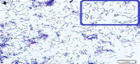 Bifidobacterium Gram Stain