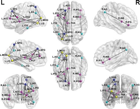 MRI Shows Brain Disruptions in Children With PTSD - Neuroscience News