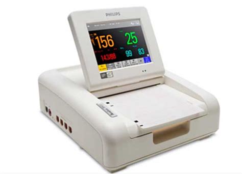 Cardiotocography (CTG)