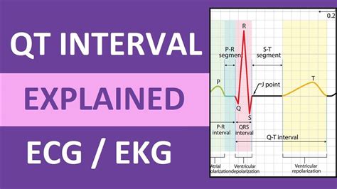 QT Interval Explained: ECG / EKG Interpretation Nursing NCLEX in 2022 | Ekg interpretation ...