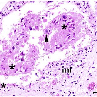 Histopathology of representative placental samples from bovine... | Download Scientific Diagram