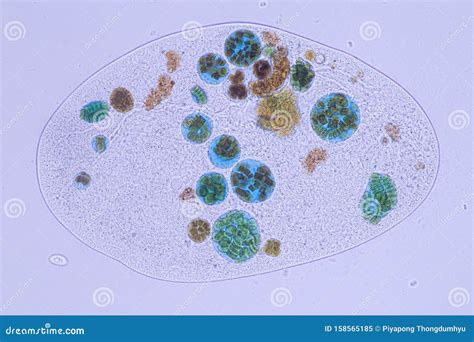 Frontonia Sp. Unicellular Ciliate Protists Under the Microscope. Stock Image - Image of ...