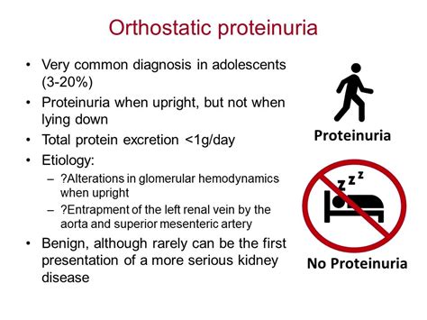 Michelle Rheault on Twitter: "Differential diagnosis of HSP/IgA vasculitis. Don't worry. It's ...