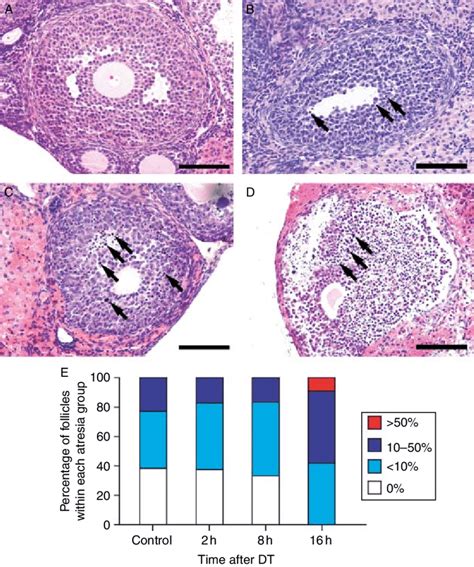 Micrographs of individual antral follicles illustrating different... | Download Scientific Diagram