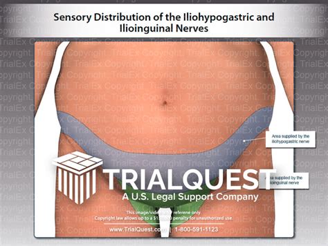 Iliohypogastric Nerve Distribution