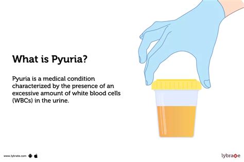 Pyuria: Causes, Symptoms & Treatment