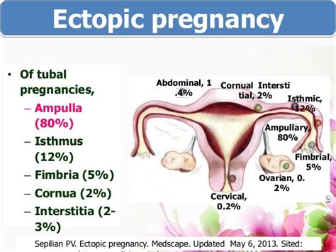 Ectopic pregnancy PBL