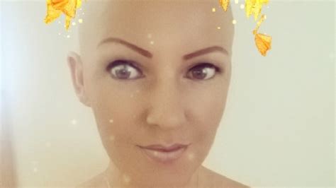 Petition · Free wigs for alopecia patients - United Kingdom · Change.org