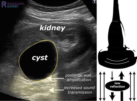 Ultrasound Technique