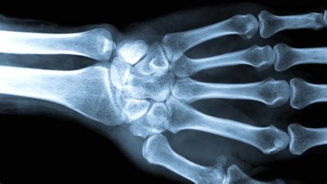 Skeleton Hand Stock Footage Video | Shutterstock