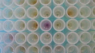 DNA extraction in action | DNA being extracted from Welsh pl… | Flickr