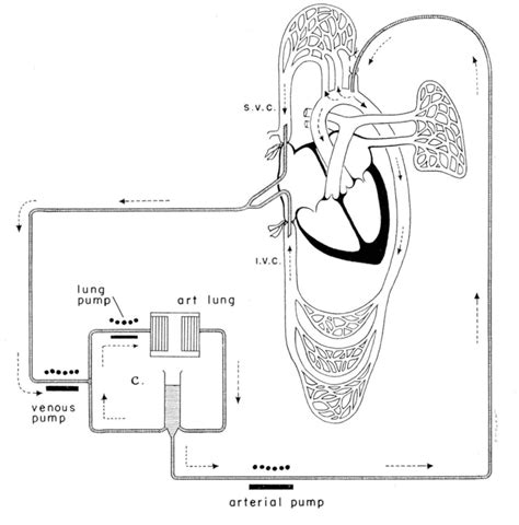 [DIAGRAM] Heart Lung Machine Diagram - MYDIAGRAM.ONLINE