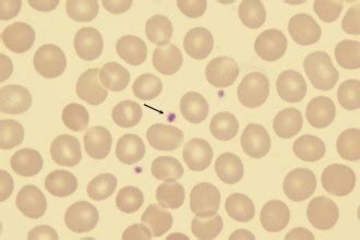 hypogranular platelet atlas : Biological Science Picture Directory – Pulpbits.net