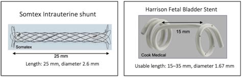 Shunt types used for thoracoamniotic shunting. | Download Scientific Diagram