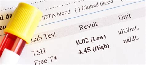 Treat Thyroid Conditions with Iodine