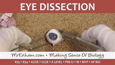 Eye Dissection - GCSE/A Level/IB Biology - YouTube