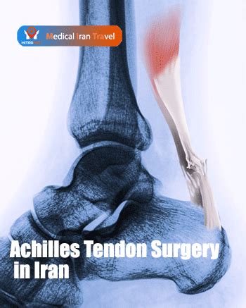 Achilles Tendon Surgery in Iran | Procedure,Risk,Result,Cost | MITRAMED