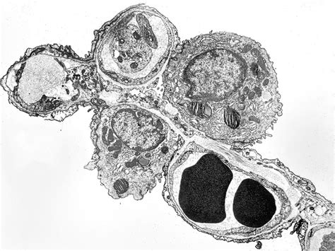 Pneumocytes EM