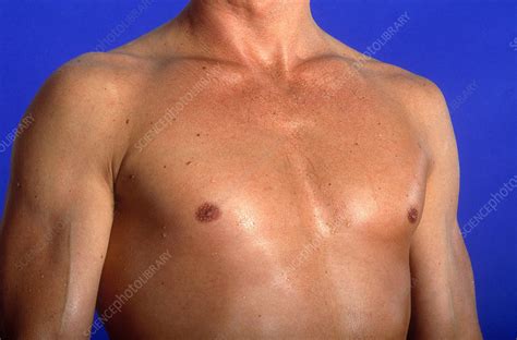 Male Chest - Stock Image - C003/4457 - Science Photo Library