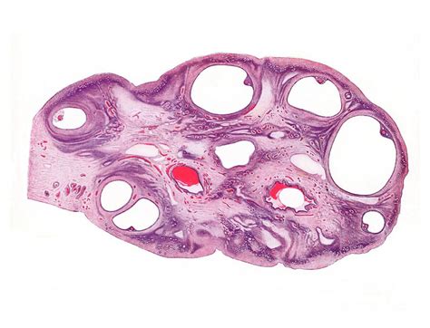 Ovary Medulla Histology