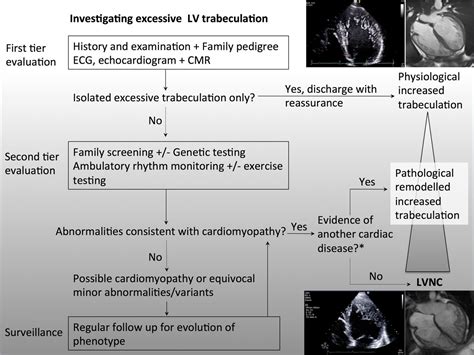 Left ventricular non-compaction cardiomyopathy: how many needles in the haystack? | Heart