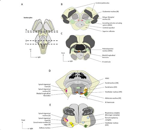 Brainstem Anatomy Cross Section