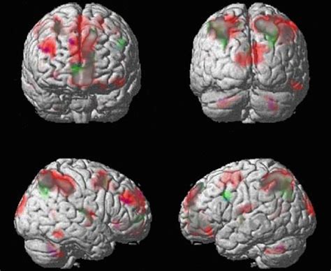 Brain on drugs scans - Business Insider