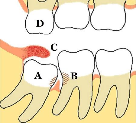 Vestigial Structure | Definition & Examples - Lesson | Study.com