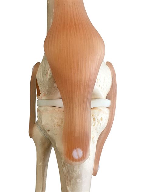 Mackie Orthopaedics | Knee arthroscopy