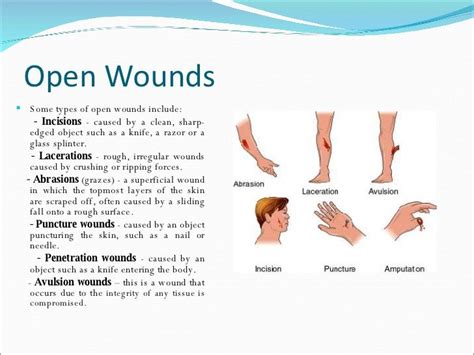 Wounds | Wounds nursing, Wound care nursing, Urgent care clinic