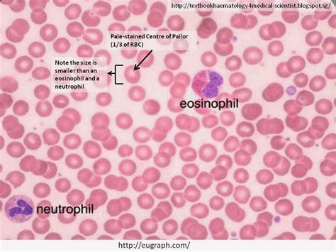 Haematology in a NutShell: Red Blood Cell Morphology