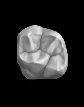 label the cusps of perm max 1st molar Diagram | Quizlet