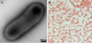 Chryseobacterium - MRGI - Microbiota Research Group of Iran