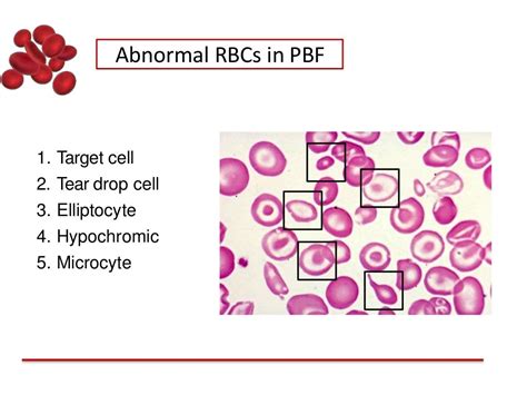 Thalassemia and Pregnancy