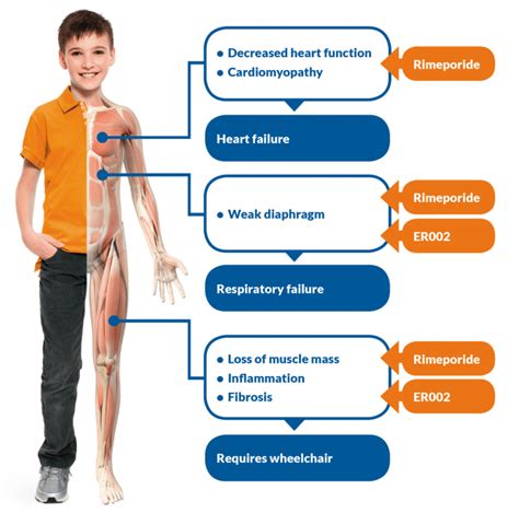 Muscular Dystrophy - Symptoms, Causes & 02 Risk Factors